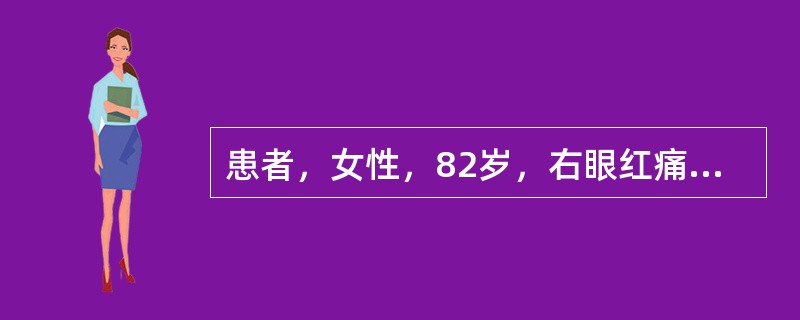 患者，女性，82岁，右眼红痛2天，检查右眼视力：FC/<st1:chmetcnv unitname="cm" sourcevalue="10" hassp