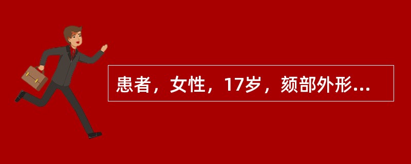 患者，女性，17岁，颏部外形发育不良，口唇闭合时口腔周围肌肉呈现紧张状态，面下1／3高度偏大，开5mm，覆盖8mm，磨牙呈现完全的Ⅱ类咬合关系，上下颌前牙拥挤明显，前牙开，左右上中切牙唇侧扭转，左右上