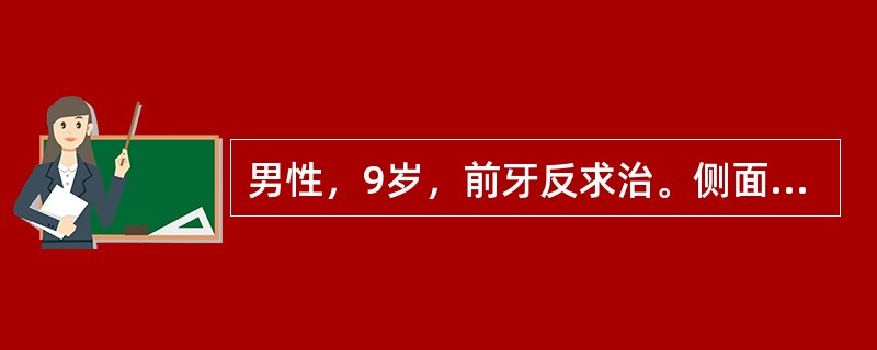 男性，9岁，前牙反求治。侧面观凹面型，上颌后缩，下颌基本正常。口内检查：前牙反，双侧磨牙近中尖对尖，下颌不可退至对刃。反覆Ⅱ度，覆盖Ⅱ度，双侧尖牙萌出间隙不足。X线头影测量结果：SNA77°，SNB7