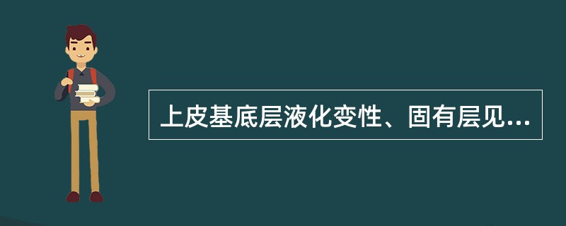 上皮基底层液化变性、固有层见密集的淋巴细胞浸润带常见于