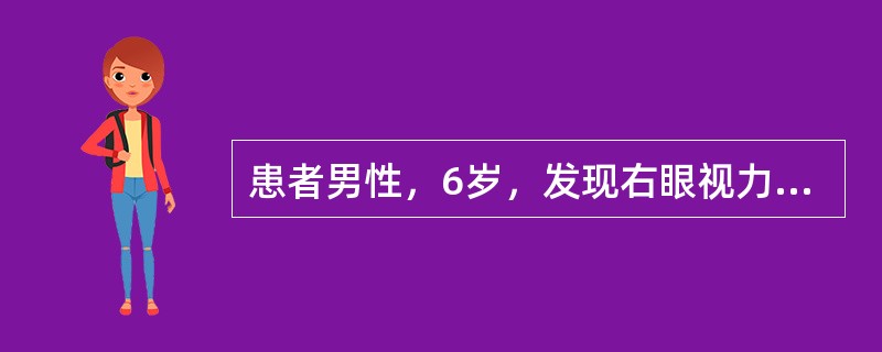 患者男性，6岁，发现右眼视力差2个月。Vod指数/10cm，右眼压33mmHg，右眼无充血，角膜直径14mm，可见Haab线，角巩缘扩张，前房轴深5CT，房水（一），晶状体透明，C/D0.95。Vos