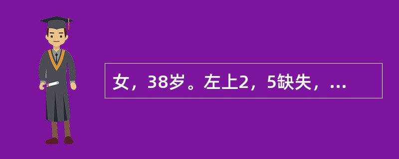 女，38岁。左上2，5缺失，近远中间隙可，咬合正常。左上1，3，4牙体，牙周组织健康。左上6残冠，无松动，X线检查示已行根管治疗，根长度可。欲加强左上6固位体的固位力，下列哪项方法无效?（　　）