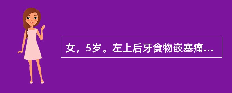 女，5岁。左上后牙食物嵌塞痛1周。检查：左上第二乳磨牙近中拾面深龋洞，探疼痛，叩诊（-）。左上第一乳磨牙远中充填体不密合继发龋较深，Ⅱ度松动，叩诊不适，颊侧牙龈有一窦道，探针可以探入左上第一乳磨牙还需