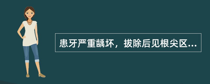 患牙严重龋坏，拔除后见根尖区附着一团组织。镜下以淋巴细胞、浆细胞浸润，血管内皮细胞和成纤维细胞增生为特征，并见不规则上皮岛和泡沫细胞。病理诊断应是（　　）。