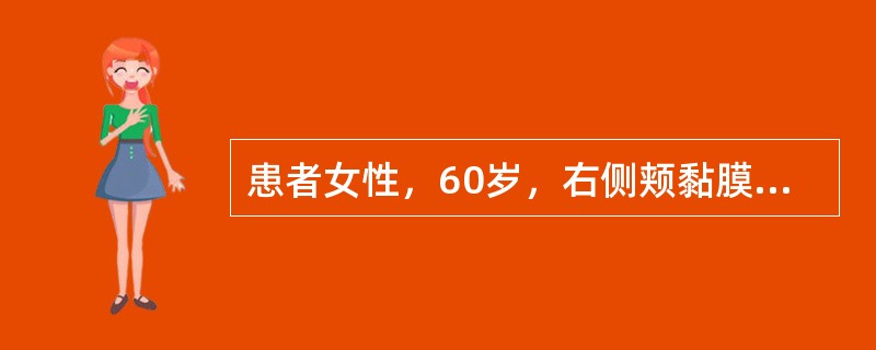 患者女性，60岁，右侧颊黏膜下肿物8个月，逐渐增大，轻度疼痛，近来在进食时常咬颊，造成局部黏膜糜烂。检查见右侧肿块大小约2cm×2.5cm，界限不清，表面黏膜糜烂，质地硬。该患者最可能是下列哪项诊断？