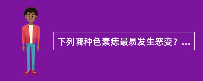下列哪种色素痣最易发生恶变？（　　）