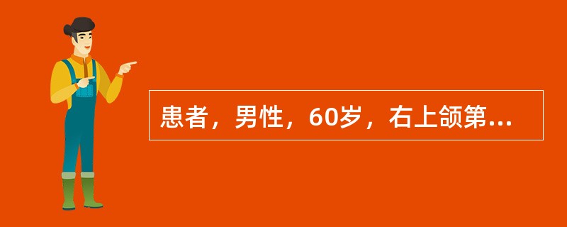 患者，男性，60岁，右上颌第一、第二磨牙残根，不松，左上颌中切牙和侧切牙松动Ⅲ度，根露1/2，测血压l60／90mmHg，心电图检查正常拔除<img border="0" s