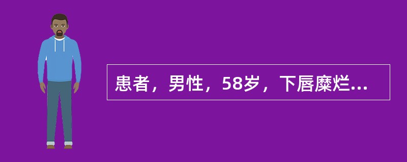 患者，男性，58岁，下唇糜烂半年不愈。临床检查见下唇唇红部有1cm×2cm红色萎缩斑，中央微凹陷，边缘隆起有放射状白色角化条纹。口腔内未见它处病损。下列哪项不是该病的病理表现？（　　）