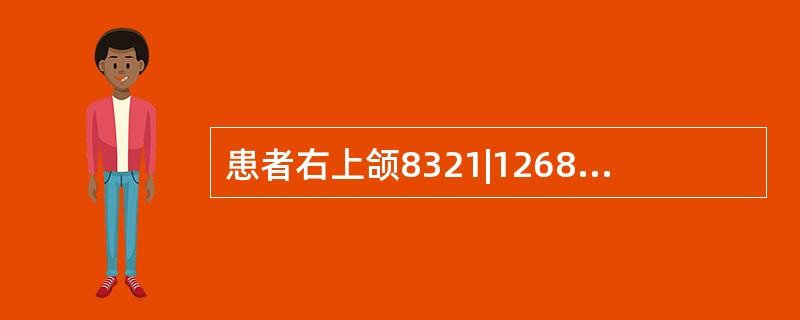 患者右上颌8321|1268缺失，前部牙槽嵴欠丰满，组织倒凹明显，76|67无接触点、食物嵌塞。模型向后倾斜使7|颊侧形成（　　）。