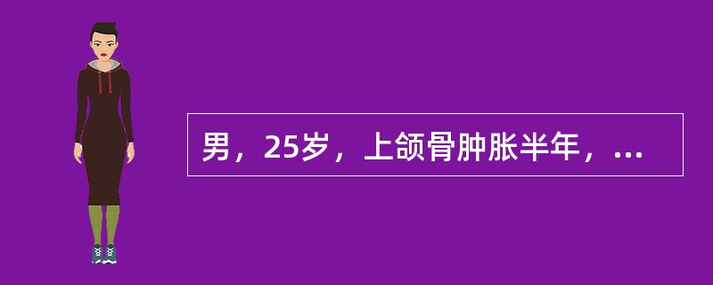 男，25岁，上颌骨肿胀半年，X线见病变区呈毛玻璃状，边界不清。镜下见纤维组织代替了正常骨组织，骨小梁形态不一，呈“O”、“C”或“V”形，骨小梁的周围未见成排的成骨细胞。病理诊断应为（　　）。