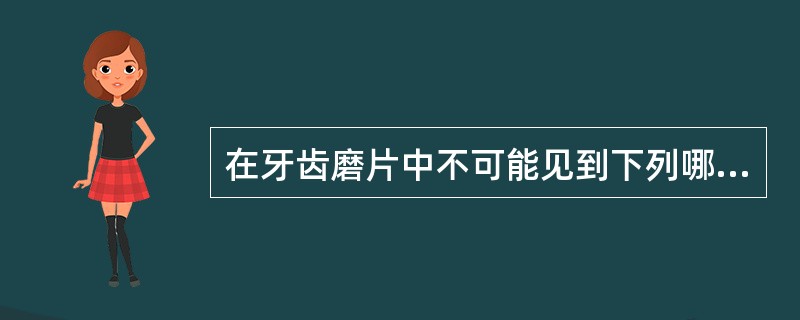 在牙齿磨片中不可能见到下列哪种结构?（　　）