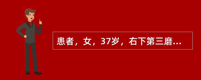 患者，女，37岁，右下第三磨牙缺失，第二磨牙Ⅲ度根分叉病变，远中根垂直吸收近根尖，近中根骨吸收达根长1／3，牙微松动，最佳治疗方案是（　　）。