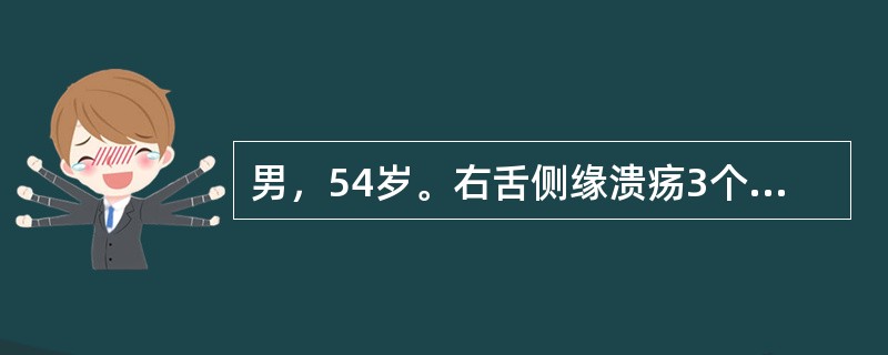 男，54岁。右舌侧缘溃疡3个月，全身一般情况良好。检查：溃疡大小约3.5cm，同侧颈深上扪及一肿大淋巴结，直径3cm，未发现远处转移征象。活检病理诊断为“舌高分化鳞状细胞癌”。如该患者的转移淋巴结大于