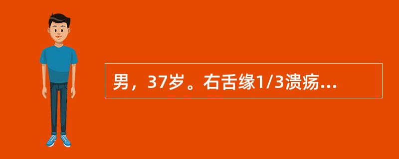 男，37岁。右舌缘1/3溃疡2周余，扩展较快，伴有疼痈，近1周出现右下颌下淋巴结肿大，最可能考虑的临床诊断是（　　）。