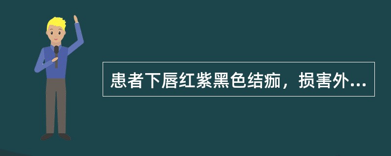 患者下唇红紫黑色结痂，损害外围放射状短白纹，唇红近皮肤侧黑色素沉着。该疾病的病理改变有（　　）。