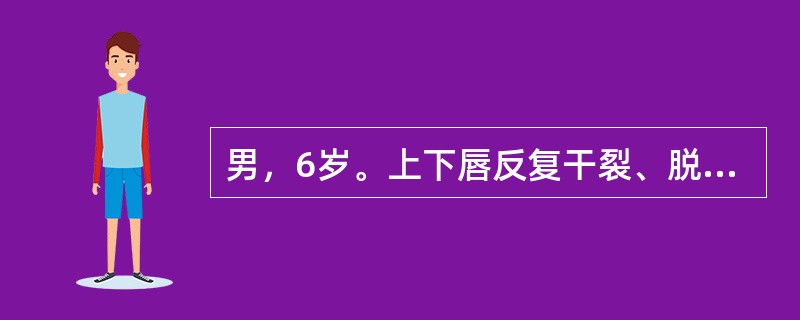 男，6岁。上下唇反复干裂、脱皮2年，秋冬季加重。患儿有舔唇不良习惯。检查见上下唇轻度肿胀，唇红黏膜干燥，表面可见大量的灰白色鳞屑及痂皮。该患者可能的诊断是