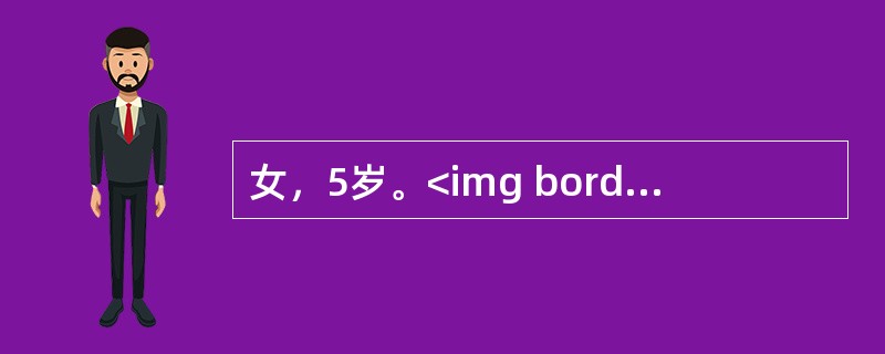 女，5岁。<img border="0" src="https://img.zhaotiba.com/fujian/20220820/gqfmkq1yxt4.png