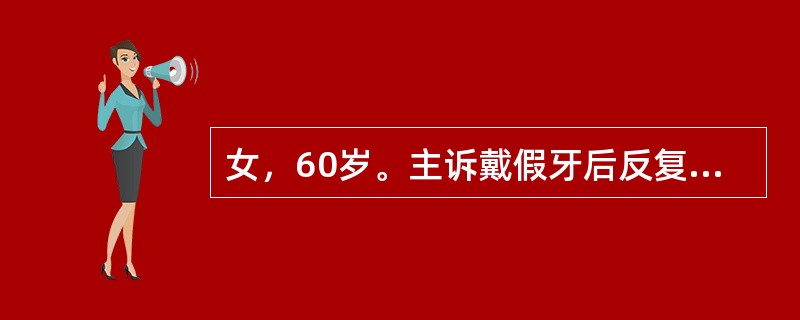 女，60岁。主诉戴假牙后反复出现口底部疼痛2个月。检查：舌系带附着处有一线状溃疡，约2.0cm×0.2cm大小，周边有组织增生，戴义齿后，义齿舌侧基托边缘正好压迫于溃疡处最可能的诊断是（　　）。