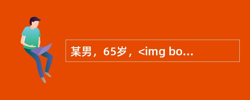 某男，65岁，<img border="0" style="width: 77px; height: 29px;" src="https://i