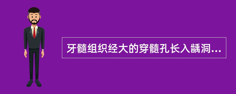 牙髓组织经大的穿髓孔长入龋洞时为（　　）。
