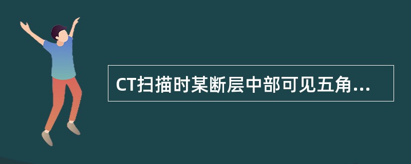 CT扫描时某断层中部可见五角形的鞍上池，由大脑纵裂池、外侧窝池、交叉池和桥池组成。<br />鞍上池内没有的结构是（）