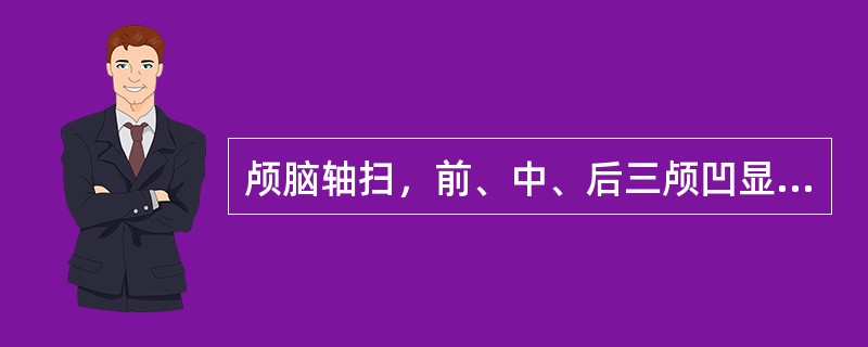 颅脑轴扫，前、中、后三颅凹显示均理想的扫描基线应采用（）