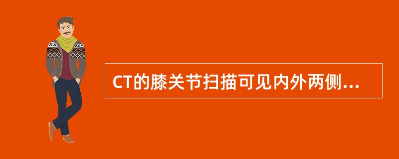 CT的膝关节扫描可见内外两侧的半月板，其密度均匀，CT值在（）
