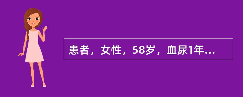 患者，女性，58岁，血尿1年余，右腰痛10天余，CT右肾下极60mm×70mm肿块，突出肾外，中心有不规则低密度区，增强扫描早期病灶明显强化，中心低密度区无强化。最可能诊断为（　　）。