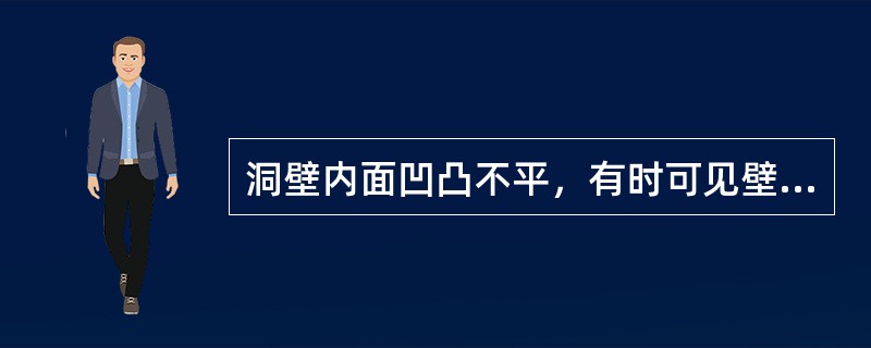 洞壁内面凹凸不平，有时可见壁结节（　　）。