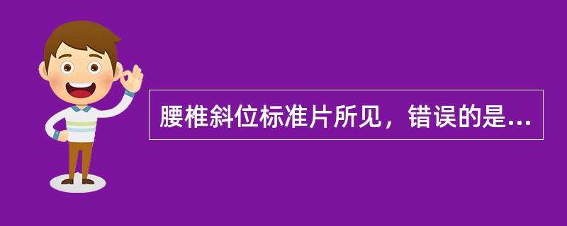腰椎斜位标准片所见，错误的是（　　）。