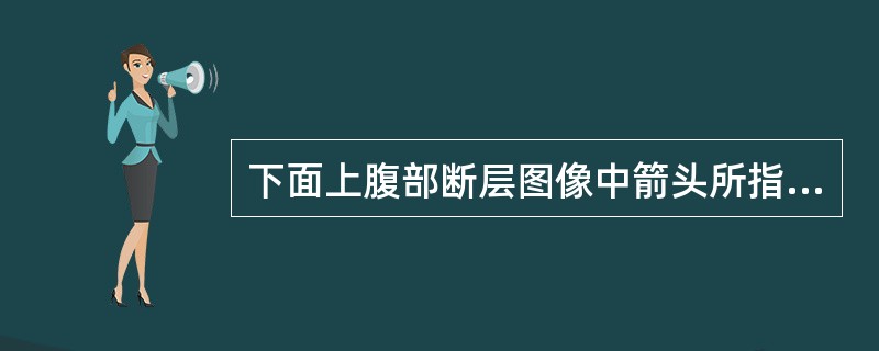 下面上腹部断层图像中箭头所指为（）<img border="0" style="width: 291px; height: 290px;" src=&qu