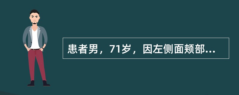 患者男，71岁，因左侧面颊部疼痛两三年入院，疼痛呈针刺样，分布在左唇部及鼻翼旁，每次发作持续5～20秒钟，吃饭，说话等可诱发疼痛。口服卡马西平0.1g，tid效果欠佳，加量后伴有头晕症状。患者最终决定