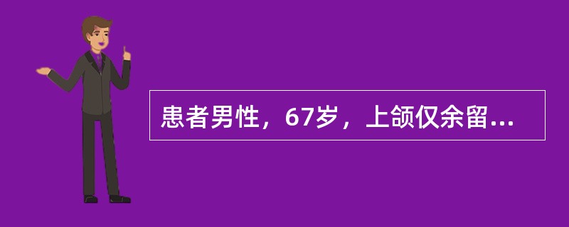 患者男性，67岁，上颌仅余留双侧尖牙，下颌双侧第一磨牙缺失，拟行可摘局部义齿修复，下颌设计舌杆大连接体</p><p> </p><br />混合