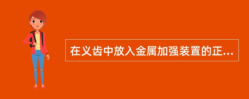 在义齿中放入金属加强装置的正确方法