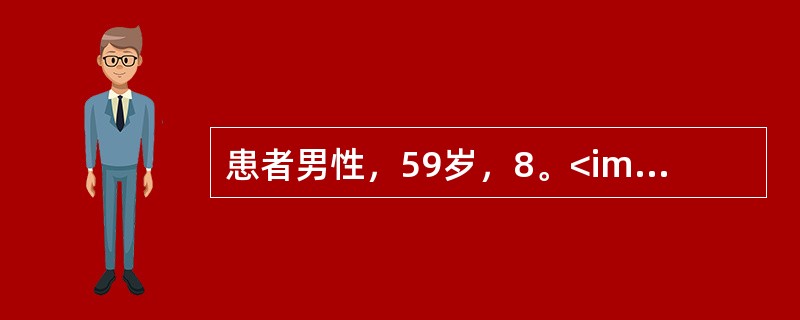 患者男性，59岁，8。<img border="0" src="https://img.zhaotiba.com/fujian/20220820/sroobawck