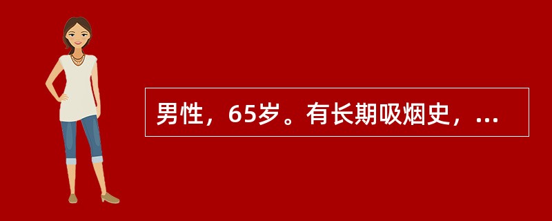 男性，65岁。有长期吸烟史，反复咳嗽、咳脓痰伴间断少量咯血20余年，大咯血3天来诊。体检：右下肺可闻及固定湿啰音。胸片示右下肺纹理增重，可见卷发影。最可能的诊断是