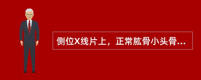 侧位X线片上，正常肱骨小头骨骺略似（　　）。