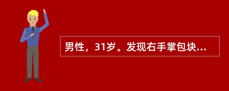 男性，31岁。发现右手掌包块6个月。查体：右手掌中部有一直径为5cm卵圆形包块，突出于表皮，与皮肤粘连，质硬，可活动，有轻压痛。最可能的诊断是（　　）。