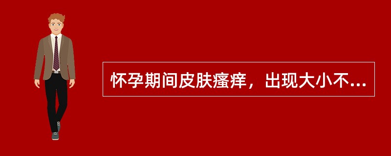 怀孕期间皮肤瘙痒，出现大小不等的风团，上半身尤甚，疹块色红有灼热感，剧痒遇热加重，舌红苔黄，脉浮滑数，治则是