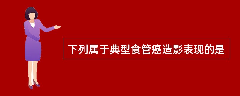 下列属于典型食管癌造影表现的是