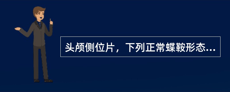 头颅侧位片，下列正常蝶鞍形态中，不正确的是下列哪项？（　　）