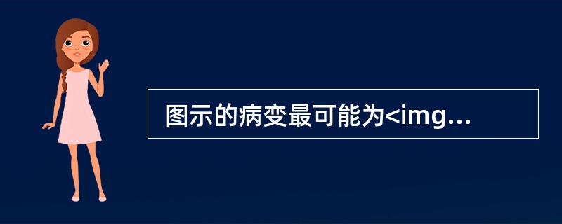  图示的病变最可能为<img src="https://img.zhaotiba.com/fujian/20220820/xbzo4l20pgr.png" alt=