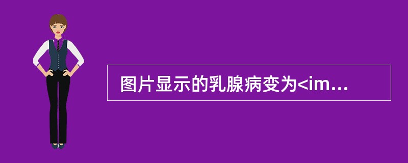  图片显示的乳腺病变为<img border="0" src="https://img.zhaotiba.com/fujian/20220820/x4ez