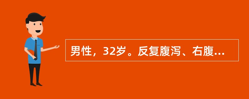 男性，32岁。反复腹泻、右腹痛5个月，低热1周入院。入院查体：T37.5～38.5℃，肝脾不大，肝区轻叩痛，右下腹轻压痛，未扪及包块，血象WBC10×109/L,N0.8;超声检查：右肝后叶上段见5.