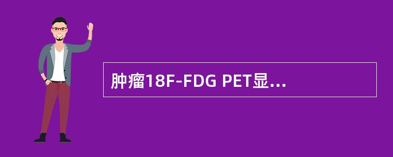 肿瘤18F-FDG PET显像时，肿瘤组织摄取显像剂相关因素有（　　）。