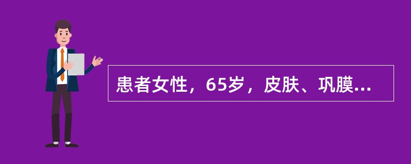 患者女性，65岁，皮肤、巩膜黄染30天，伴皮肤瘙痒、厌食、乏力、消瘦、小便黄、大便发白等；既往史无特殊。体检：皮肤、巩膜黄染，腹部无压痛反跳痛，肝区无叩击痛，可及肿大的胆囊，腹水征阴性。实验室检查：T