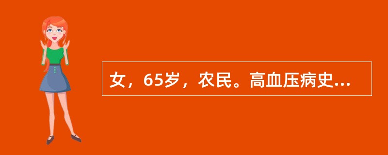 女，65岁，农民。高血压病史12年，不规则服药，某日晨起突发头痛，意识不清，35分钟后送至医院，体检：昏迷，血压220／120mmHg，双眼右侧凝视，左足外旋位。<br />最可能的诊断是