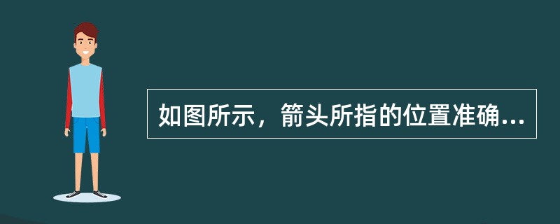 如图所示，箭头所指的位置准确的解剖描述是<img border="0" style="width: 306px; height: 306px;" src=