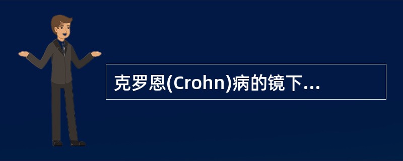 克罗恩(Crohn)病的镜下病变不包括