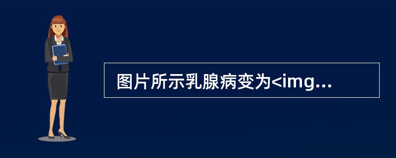  图片所示乳腺病变为<img border="0" src="https://img.zhaotiba.com/fujian/20220820/paqb4